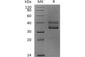 Western Blotting (WB) image for CD3 epsilon (CD3E) (Active) protein (mFc Tag) (ABIN7319783)