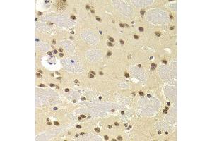 Immunohistochemistry of paraffin-embedded mouse brain using SNRPA Antibody. (SNRPA1 anticorps  (AA 1-282))