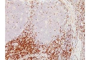 Formalin-fixed, paraffin-embedded human tonsil stained with CD5 antibody (CD5/54/F6)