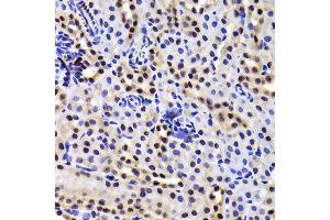 Immunohistochemistry of paraffin-embedded Mouse kidney using GABPB1 antibody at dilution of 1:100 (x400 lens). (GABPB1 anticorps)