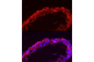 Immunofluorescence analysis of human testis cells using SP Rabbit pAb (ABIN3022967, ABIN3022968, ABIN1513554 and ABIN6219322) at dilution of 1:150 (40x lens). (SPAM1 anticorps  (AA 100-300))