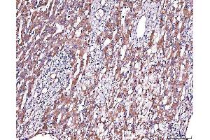 IHC analysis of Alpha 2 Antiplasmin/SERPINF2 using anti-Alpha 2 Antiplasmin/SERPINF2 antibody (ABIN7601808). (alpha 2 Antiplasmin anticorps  (AA 461-491))
