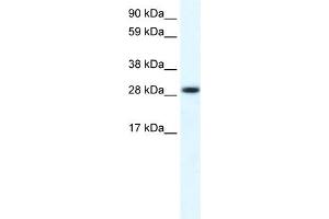 WB Suggested Anti-FHL1 Antibody Titration:  0. (FHL1 anticorps  (C-Term))