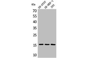 Western Blot analysis of SH-SY5Y 293 SK-HEP-1 cells using Phospho-Synuclein-α (Y125) Polyclonal Antibody (SNCA anticorps  (pTyr125))