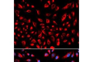 Immunofluorescence analysis of U2OS cells using CLDN11 Polyclonal Antibody (Claudin 11 anticorps)