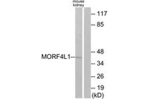 Western blot analysis of extracts from mouse kidney cells, using MORF4L1 Antibody. (MORF4L1 anticorps  (AA 31-80))