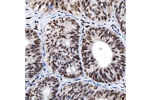 IHC analysis of SNRNP200 using anti-SNRNP200 antibody (ABIN7602032).