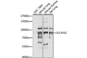 Western blot analysis of extracts of various cell lines, using SLC44A2 antibody (ABIN6291931) at 1:1000 dilution. (SLC44A2 anticorps)