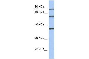 WB Suggested Anti-RPH3A Antibody Titration:  0. (RPH3A anticorps  (N-Term))