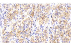 Detection of CK13 in Human Stomach Tissue using Polyclonal Antibody to Cytokeratin 13 (CK13)