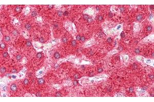 Detection of C4 in Human Liver Tissue using Polyclonal Antibody to Complement Component 4 (C4)