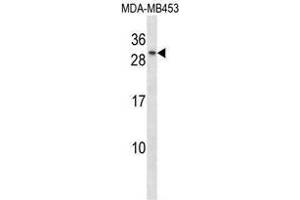 TGIF2 Antibody (C-term) western blot analysis in MDA-MB453 cell line lysates (35 µg/lane). (TGIF2 anticorps  (C-Term))