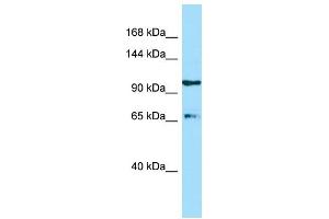 WB Suggested Anti-ESF1 Antibody Titration: 1. (ESF1 anticorps  (C-Term))