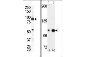 (LEFT)Western blot analysis of anti-EphA4 Pab in NCI-H460 cell lysate.