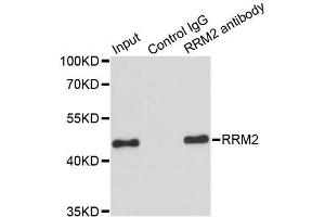 Immunoprecipitation analysis of 200 μg extracts of HeLa cells using 1 μg RRM2 antibody (ABIN5973030).