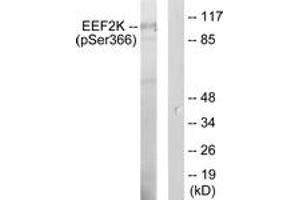 Western blot analysis of extracts from HeLa cells treated with serum 10 % 15', using eEF2K (Phospho-Ser366) Antibody. (EEF2K anticorps  (pSer366))