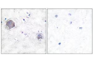 Immunohistochemistry (IHC) image for anti-Notch 1 (NOTCH1) (Cleaved-Val1754), (Internal Region) antibody (ABIN1853472) (Notch1 anticorps  (Cleaved-Val1754, Internal Region))