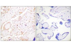 Immunohistochemistry analysis of paraffin-embedded human placenta tissue using GATA3 antibody. (GATA3 anticorps)