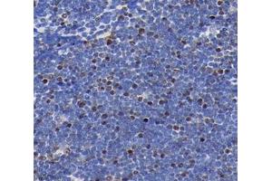 Immunohistochemistry analysis of paraffin-embedded rat thymus using,MLLT11 (ABIN7074715) at dilution of 1: 4000