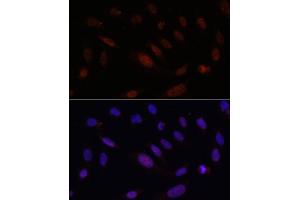 Immunofluorescence analysis of U2OS cells using Bcl9 Rabbit pAb (ABIN7265817) at dilution of 100 (40x lens). (BCL9 anticorps)