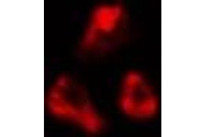 ABIN6277053 staining  LOVO cells by IF/ICC. (CDKN3 anticorps  (Internal Region))
