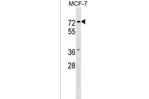 NOTUM Antibody (C-term) (ABIN1537190 and ABIN2849368) western blot analysis in MCF-7 cell line lysates (35 μg/lane). (NOTUM anticorps  (C-Term))