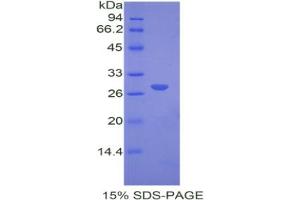 SDS-PAGE analysis of Mouse COMT Protein.