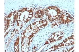 Formalin-fixed, paraffin-embedded canine (dog) colon stained with Ep-CAM Mouse Monoclonal Antibody (EGP40/1373). (EpCAM anticorps  (Extracellular Domain))