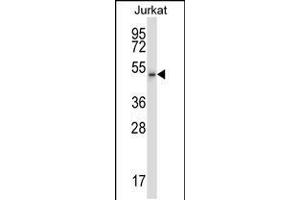 Western blot analysis in Jurkat cell line lysates (35ug/lane). (Cyclin-Dependent Kinase 15 (ALS2CR7) (AA 96-124), (N-Term) anticorps)