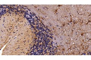 Detection of GFAP in Rat Cerebellum Tissue using Polyclonal Antibody to Glial Fibrillary Acidic Protein (GFAP) (GFAP anticorps  (AA 1-430))