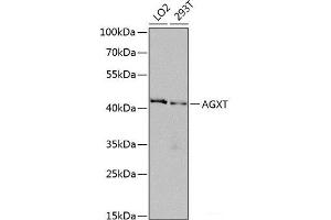 Western blot analysis of extracts of various cell lines using AGXT Polyclonal Antibody at dilution of 1:1000. (AGXT anticorps)