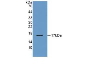 Figure. (REG3B anticorps  (AA 27-175))