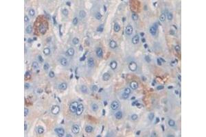 IHC-P analysis of Kidney tissue, with DAB staining. (PZP anticorps  (AA 1246-1495))