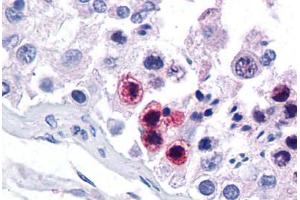 Human Testis: Formalin-Fixed, Paraffin-Embedded (FFPE)