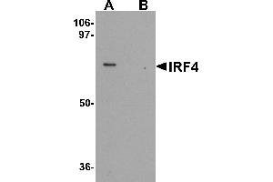 Western blot analysis of IRF4 in Jurkat cell lysate with IRF4 antibody at 1 µg/mL in (A) the absence and (B) the presence of blocking peptide.