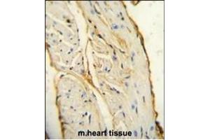 AIF1 antibody (N-term) (ABIN654407 and ABIN2844145) immunohistochemistry analysis in formalin fixed and paraffin embedded mouse heart tissue followed by peroxidase conjugation of the secondary antibody and DAB staining. (Iba1 anticorps  (N-Term))