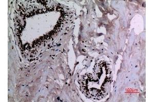 Immunohistochemical analysis of paraffin-embedded human-breast, antibody was diluted at 1:100.