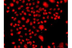 Immunofluorescence analysis of A549 cells using FANCM antibody. (FANCM anticorps)