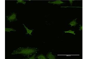 Immunofluorescence of monoclonal antibody to EFHD1 on HeLa cell.
