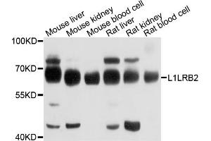 Western blot analysis of extracts of various cells, using LILRB2 antibody. (LILRB2 anticorps)