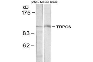 Image no. 1 for anti-Transient Receptor Potential Cation Channel, Subfamily C, Member 6 (TRPC6) (N-Term) antibody (ABIN319369)
