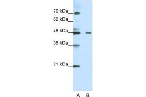 Western Blotting (WB) image for anti-Zinc Finger Protein 645 (ZNF645) antibody (ABIN2461310)