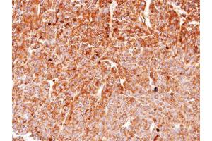 IHC-P Image Immunohistochemical analysis of paraffin-embedded BT483 xenograft, using HSP90 beta, antibody at 1:100 dilution.
