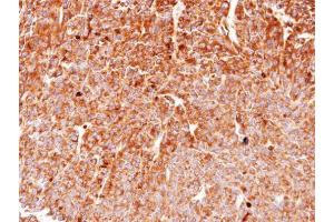 IHC-P Image Immunohistochemical analysis of paraffin-embedded BT483 xenograft, using HSP90 beta, antibody at 1:100 dilution. (HSP90AB1 anticorps  (N-Term))