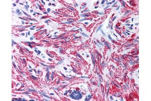Anti-MYL9 antibody IHC of human smooth muscle. (MYL9 anticorps  (AA 12-27))