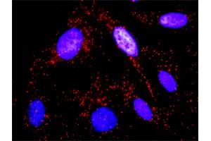 Proximity Ligation Analysis of protein-protein interactions between SYK and CTTN.