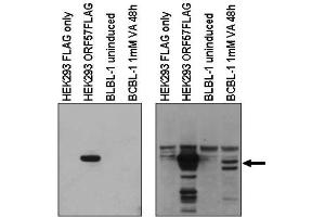 Image no. 1 for anti-Herpes Virus Type 8 (HHV8) (C-Term) antibody (ABIN401445) (HHV8 anticorps  (C-Term))