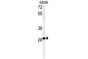 C11orf46 Antibody (C-term) western blot analysis in A2058 cell line lysates (35µg/lane). (C11orf46 anticorps  (C-Term))