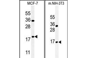 (LEFT)Western blot analysis of BTG1 Antibody (Center) (ABIN651304 and ABIN2840179) in MCF-7 cell line lysates (35 μg/lane). (BTG1 anticorps  (AA 92-118))