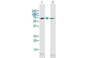 Western Blot analysis of CCT3 expression in transfected 293T cell line (CCT3 anticorps  (AA 1-544))